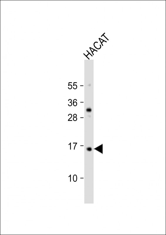 Rabbit Polyclonal Antibody to TCTA (N-Term)
