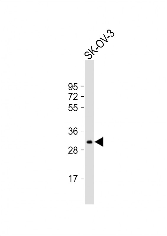Rabbit Polyclonal Antibody to IGFBP5