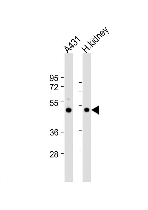 Rabbit Polyclonal Antibody to ZMPSTE24