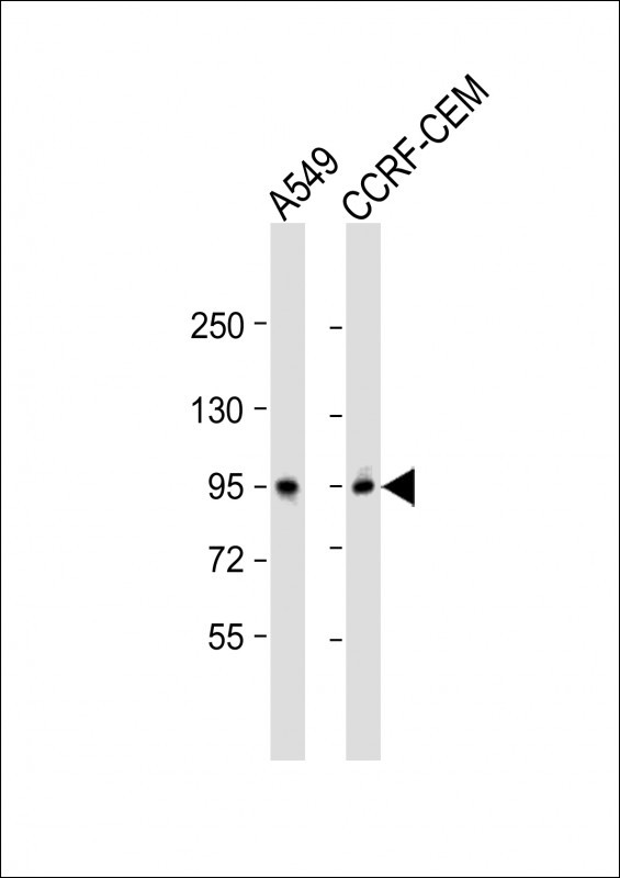 Rabbit Polyclonal Antibody to CD71