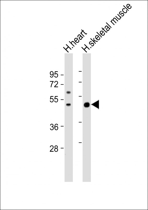 Rabbit Polyclonal Antibody to ISLR  (C-term)