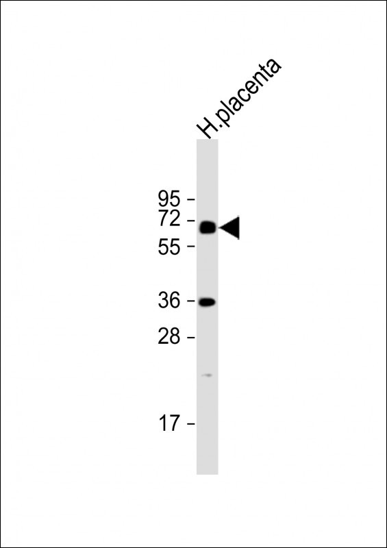 Rabbit Polyclonal Antibody to IL1R (C-term E487)