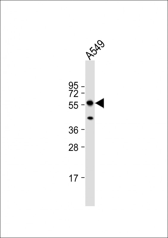 Rabbit Polyclonal Antibody to PINK1 (PARK6) (N-term T133)