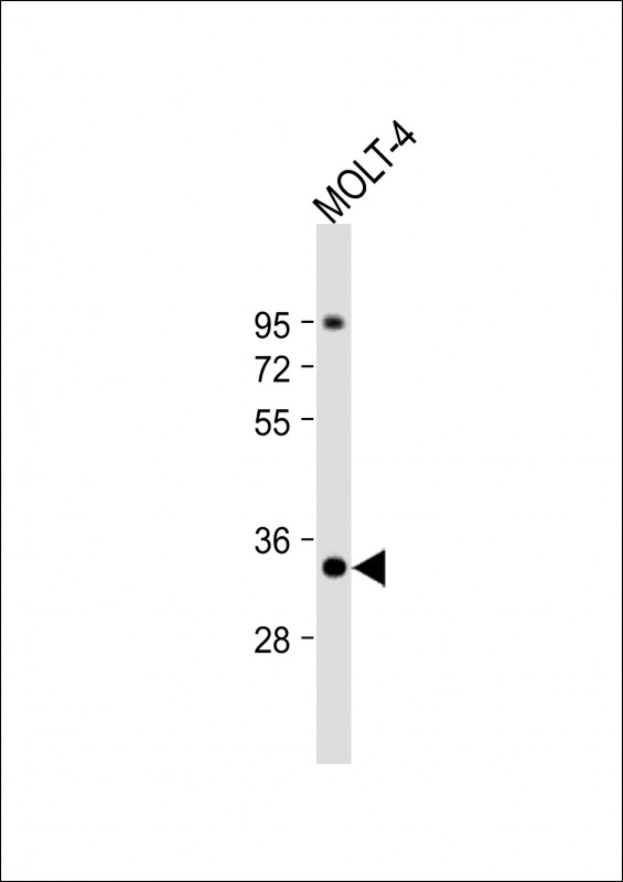 Rabbit Polyclonal Antibody to ZWINT
