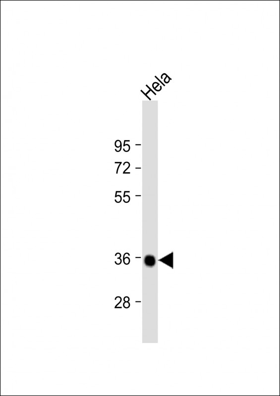 Rabbit Polyclonal Antibody to Deoxyguanosine Kinase (DGUOK)
