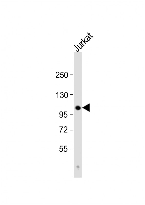 Rabbit Polyclonal Antibody to Parg