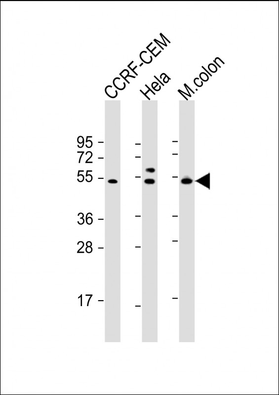 Rabbit Polyclonal Antibody to CHK1