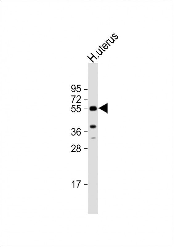 Rabbit Polyclonal Antibody to Aromatase (CYP19A1)