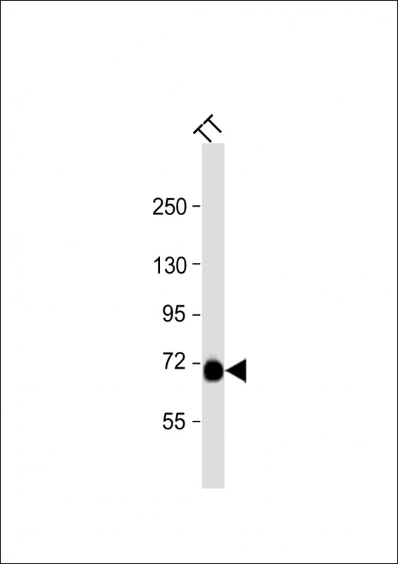 Rabbit Polyclonal Antibody to PCSK2 (N-term)