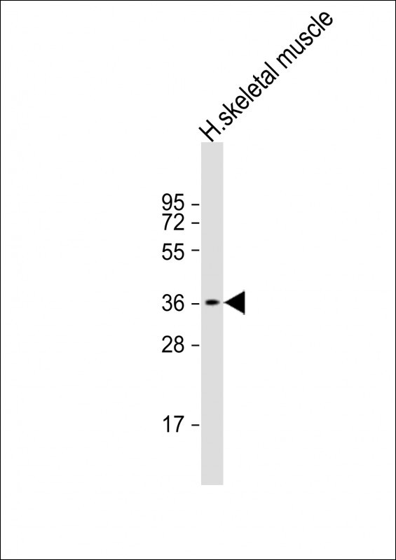 Rabbit Polyclonal Antibody to TRIB1