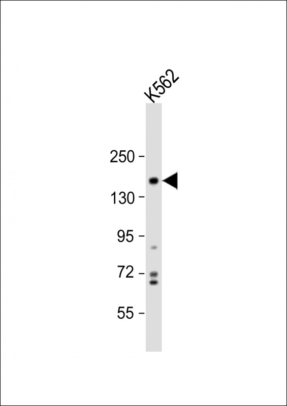 Rabbit Polyclonal Antibody to PHLPP1 (N-term)