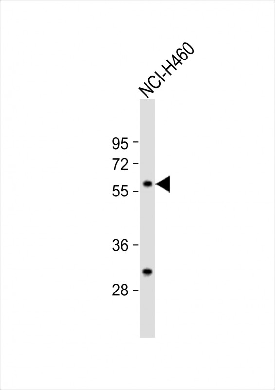 Rabbit Polyclonal Antibody to CARS2