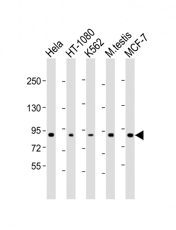 Rabbit Polyclonal Antibody to TBK1 (S172)