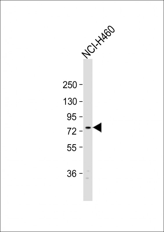 Rabbit Polyclonal Antibody to EXOC5