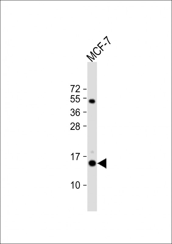 Rabbit Polyclonal Antibody to RPS24