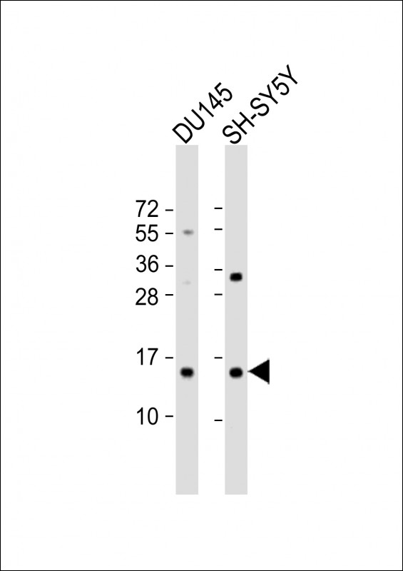 Rabbit Polyclonal Antibody to YPEL5  (C-term)