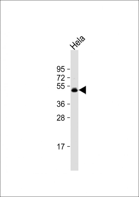 Rabbit Polyclonal Antibody to CEPT1 (N-term)