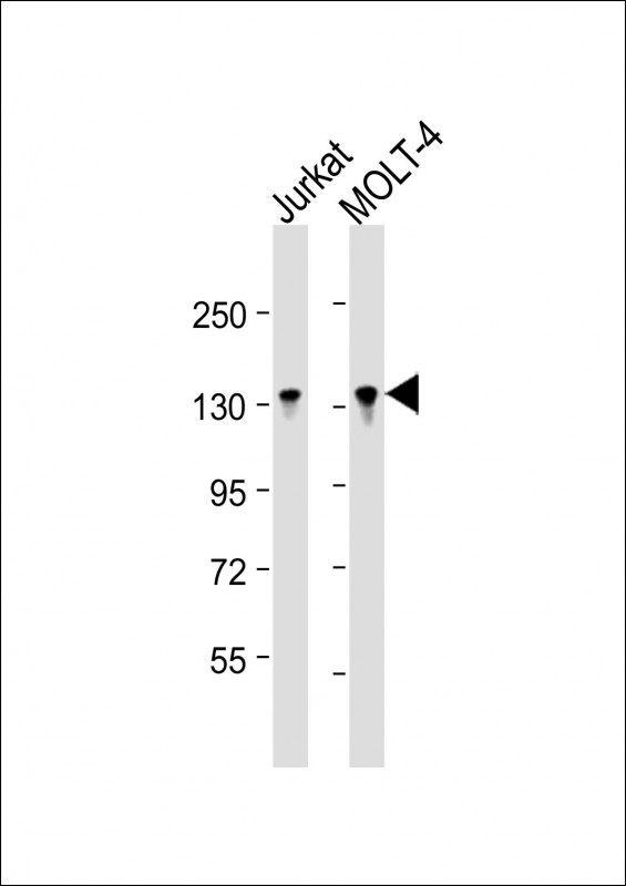 Rabbit Polyclonal Antibody to BCL11B