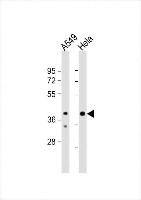 Rabbit Polyclonal Antibody to JMJD5 (N-term)