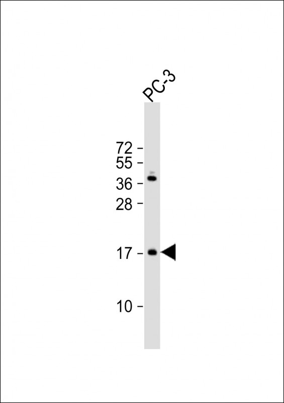 Rabbit Polyclonal Antibody to NDUF3 (N-term)