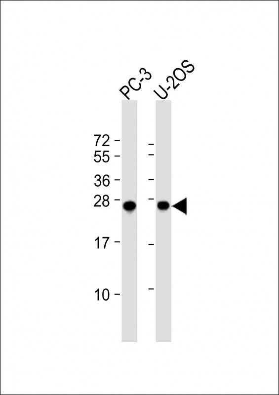 Rabbit Polyclonal Antibody to ZCCHC17