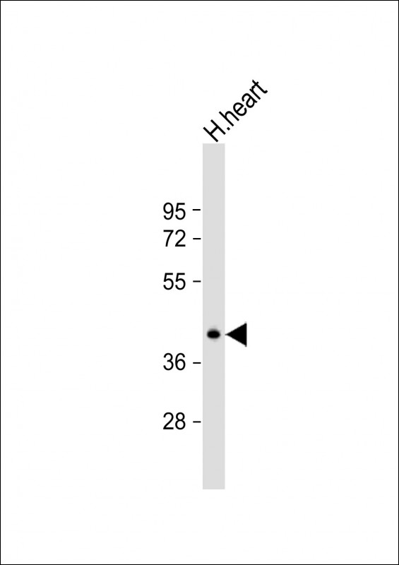 Rabbit Polyclonal Antibody to NAT12