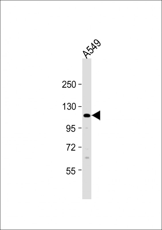 Rabbit Polyclonal Antibody to ECT2L