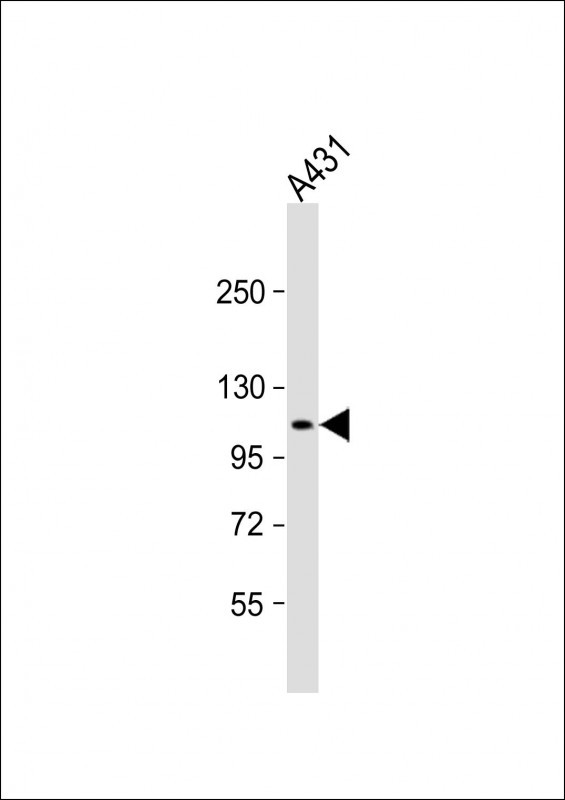 Rabbit Polyclonal Antibody to DEF  (N-term)