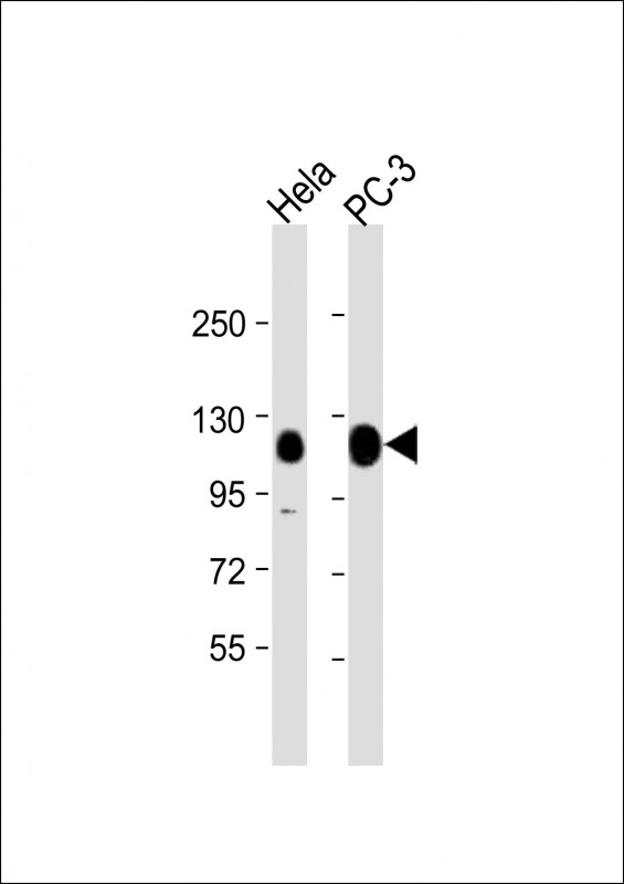 Rabbit Polyclonal Antibody to TRIM28 (N-term)