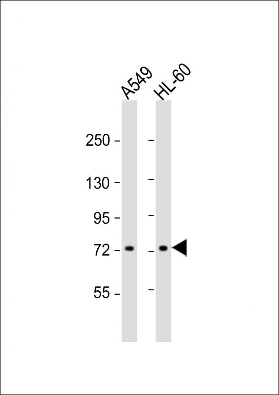 Rabbit Polyclonal Antibody to VWA2 (N-term)