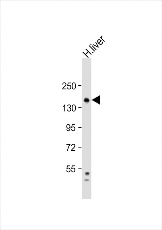Rabbit Polyclonal Antibody to RPGR