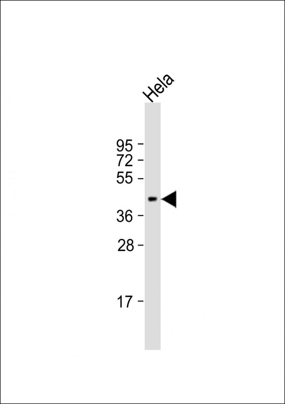 Rabbit Polyclonal Antibody to NUDT9