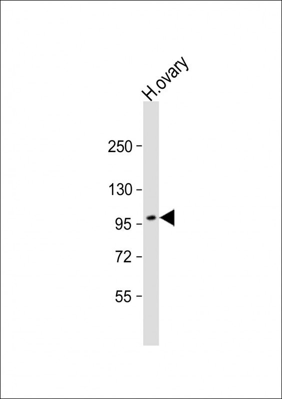 Rabbit Polyclonal Antibody to ESPNL