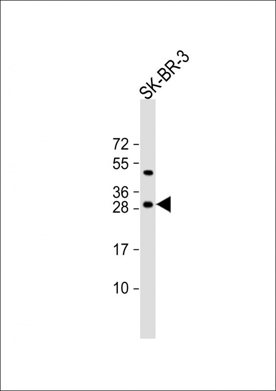 Rabbit Polyclonal Antibody to CSN2 (N-term)