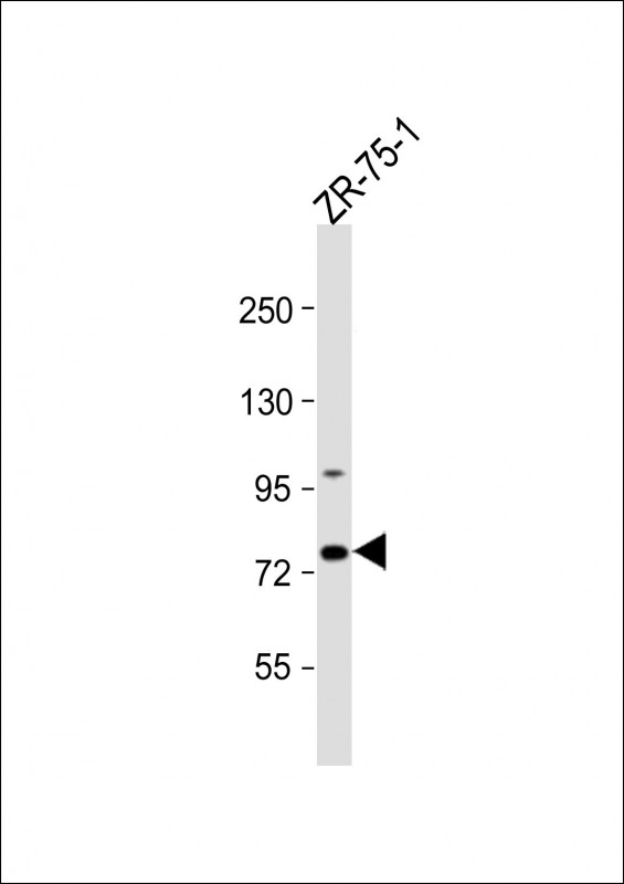 Rabbit Polyclonal Antibody to CTTNBP2NL (N-term)