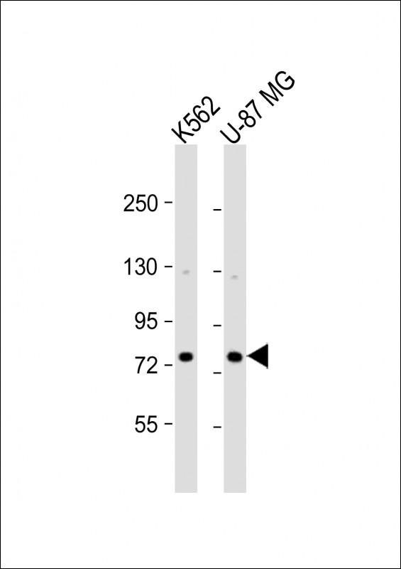 Rabbit Polyclonal Antibody to ARHGAP22