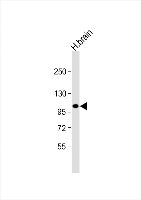 Rabbit Polyclonal Antibody to ANKRD6