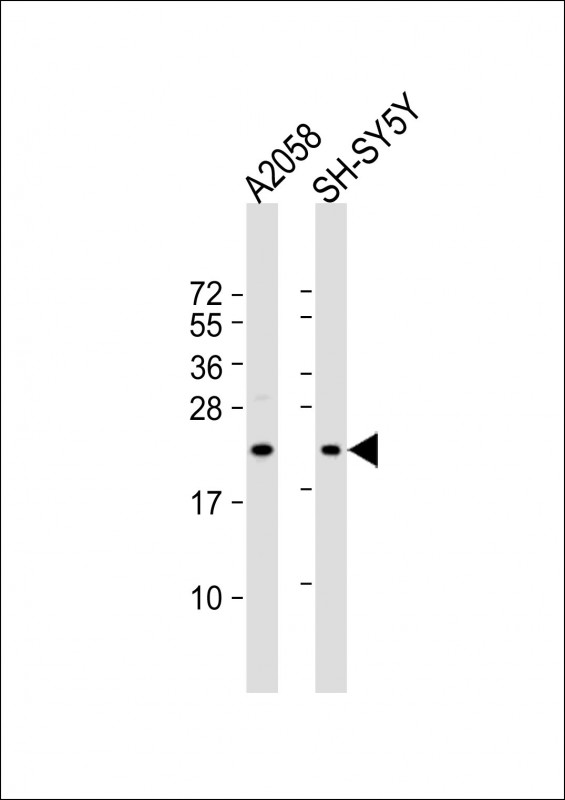 Rabbit Polyclonal Antibody to FGF11 (N-term)