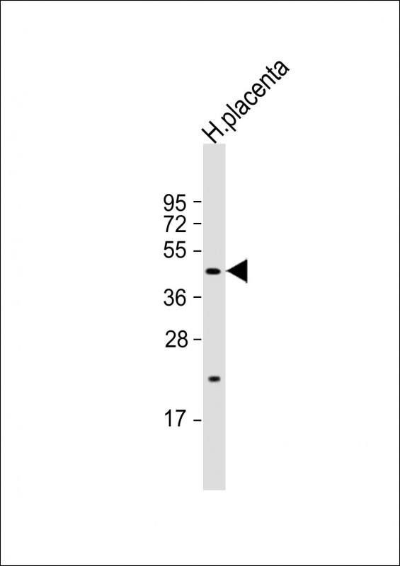 Rabbit Polyclonal Antibody to SGPP1 (N-term)