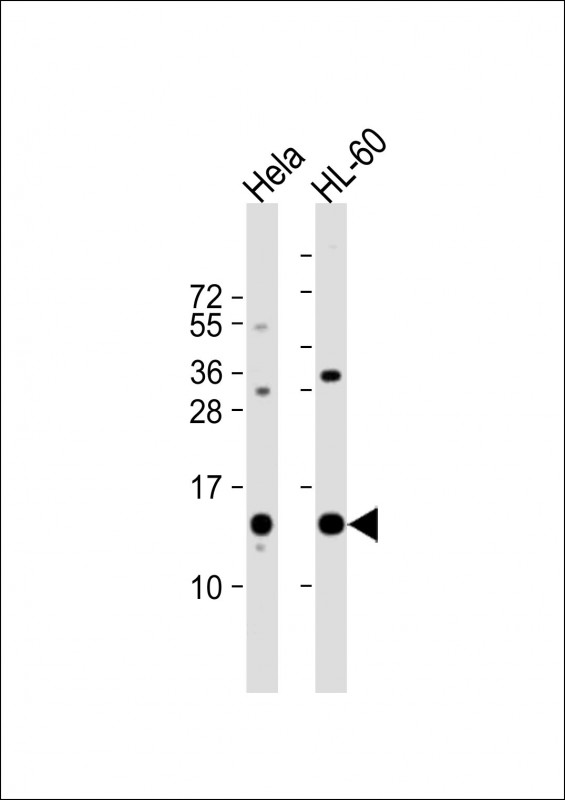 Rabbit Polyclonal Antibody to PHF5A