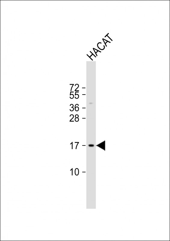 Rabbit Polyclonal Antibody to NRARP