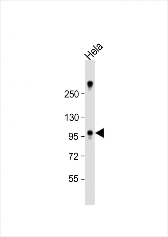 Rabbit Polyclonal Antibody to ZCCHC14