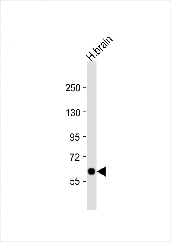Rabbit Polyclonal Antibody to SLC2A13