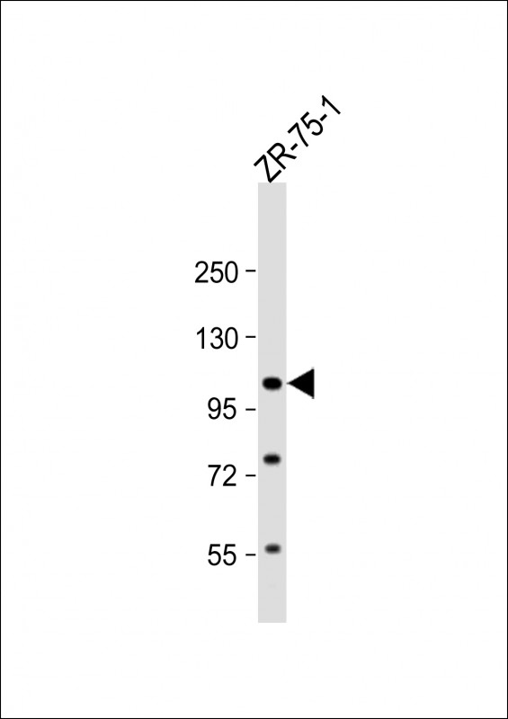 Rabbit Polyclonal Antibody to FOLH1 (N-term)