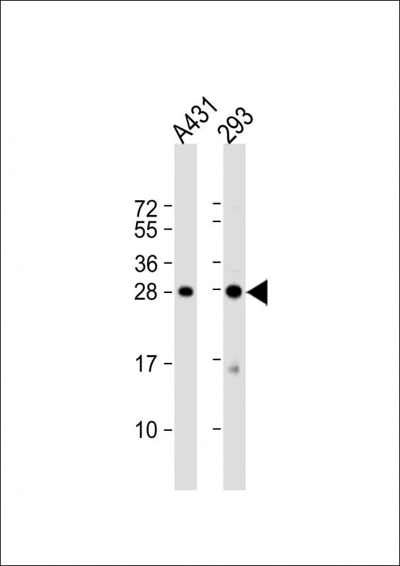 Rabbit Polyclonal Antibody to H1FX