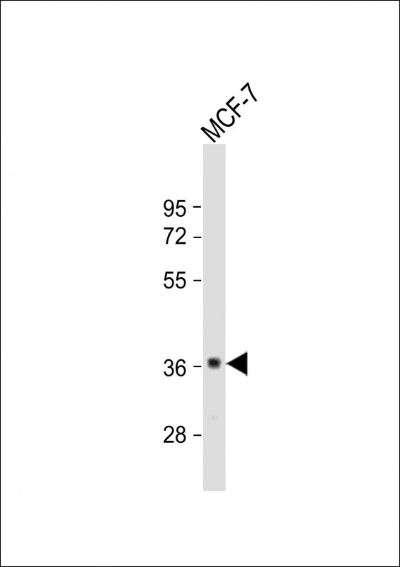 Rabbit Polyclonal Antibody to GDPD3 (N-term)