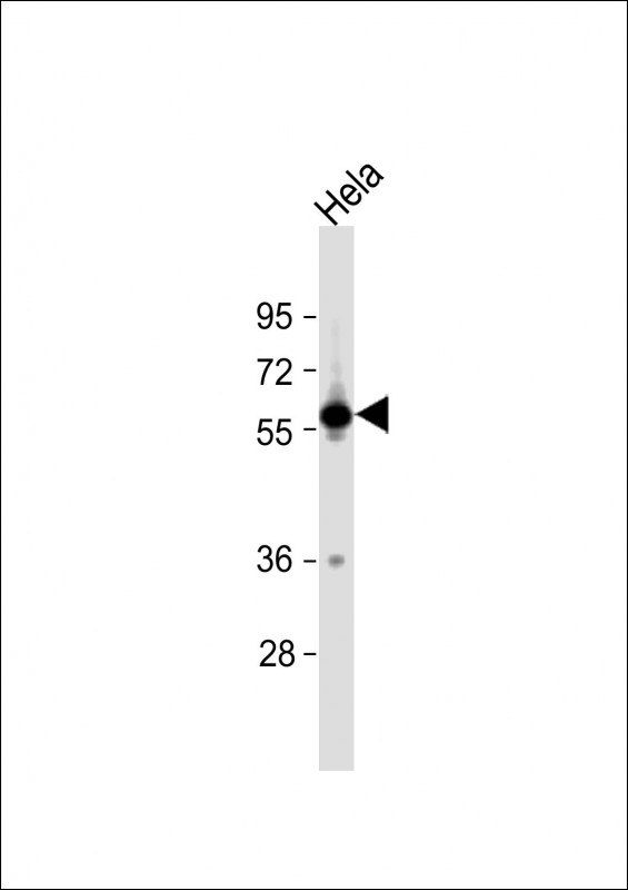 Rabbit Polyclonal Antibody to SLC30A1