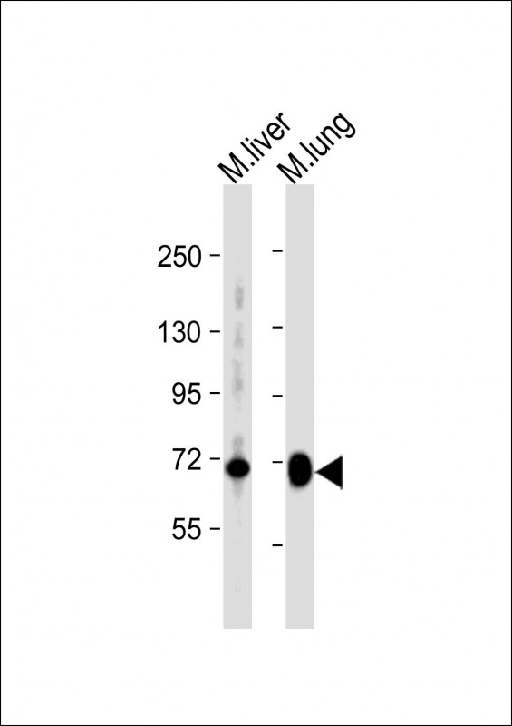 Rabbit Polyclonal Antibody to Mouse Hipk4