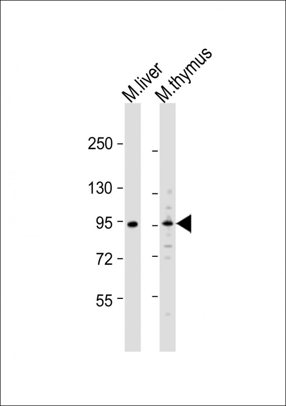 Rabbit Polyclonal Antibody to Mouse Ern1