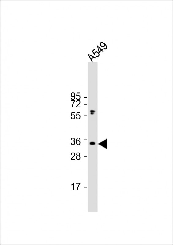 Rabbit Polyclonal Antibody to ORAI1